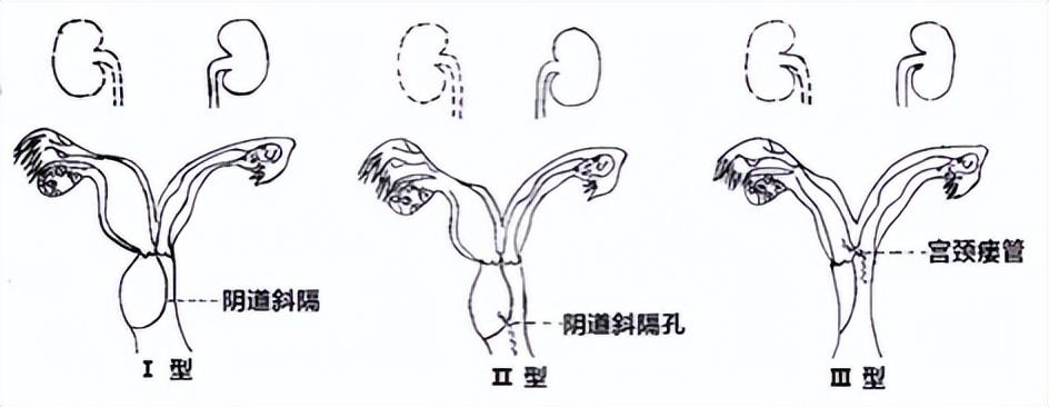 澳门王中王100%期期准另外新澳门四肖期期准免费公开，详细解答、专家解答解释落实